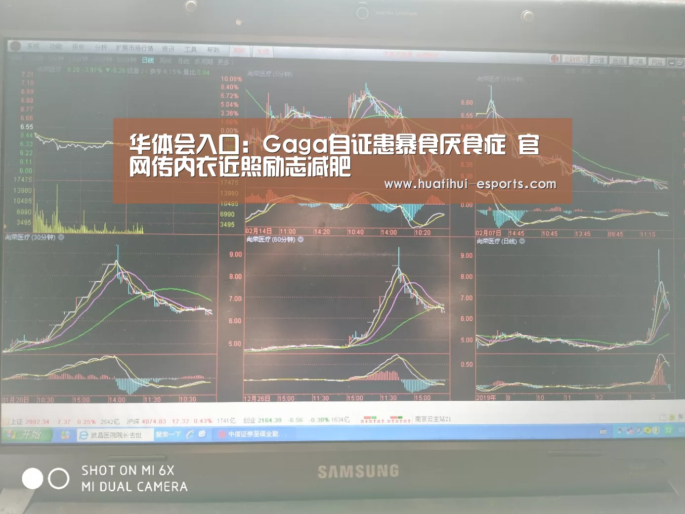 华体会入口:Gaga自证患暴食厌食症 官网传内衣近照励志减肥(图4) 华体会官网